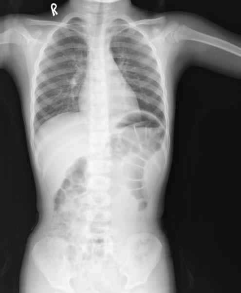 1896年1月18日X光机第一次展出(2025-1-18已更新)