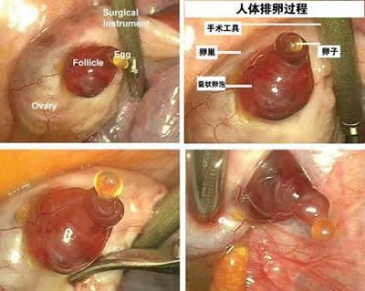 2008年6月13日首次拍得人类排卵的过程(2024-6-13已更新)